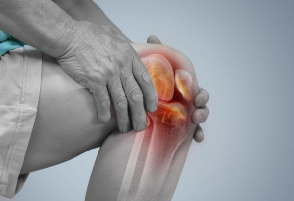 Ayurvedic Knee Pain