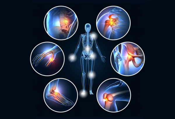 Joint pain